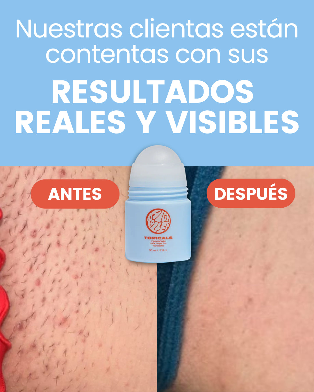 Roll-On Post Depilación para tu Zona V ❌ Evita vellos encarnados, granitos e Irritacion