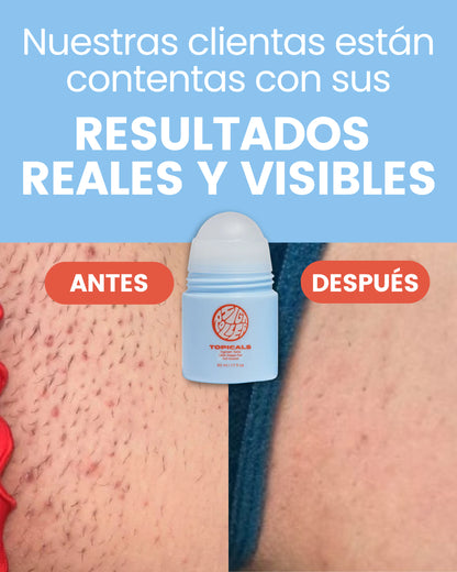 Roll-On Post Depilación para tu Zona V ❌ Evita vellos encarnados, granitos e Irritacion