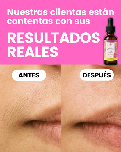 Serum natural 🌿 Reduce el crecimiento del vello corporal ¡YA NO TENDRÁS QUE DEPILARTE!✨